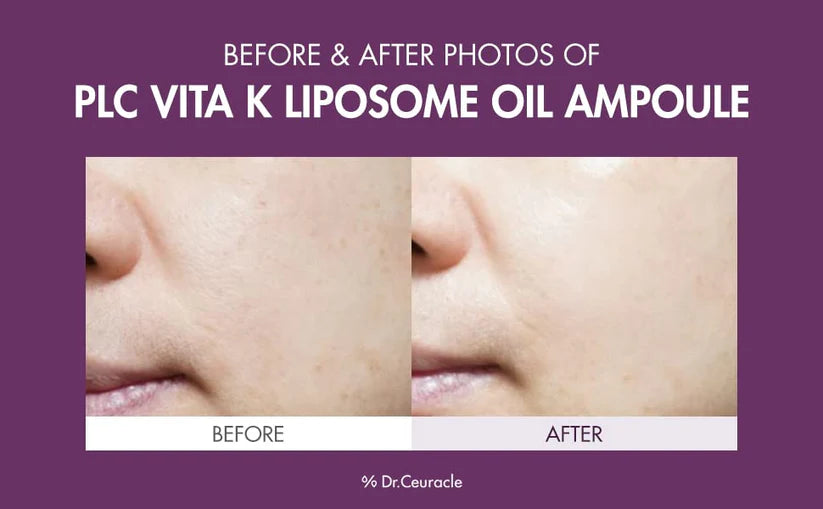 Dr. Ceuracle Ser cu Vitamina L 50ml
