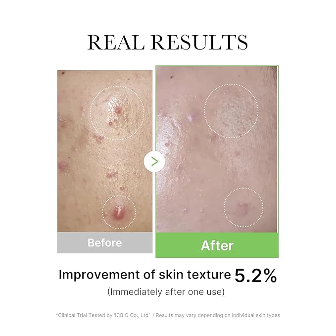 Medicube Ser pentru fațǎ cu exozomi de Centella 30ml