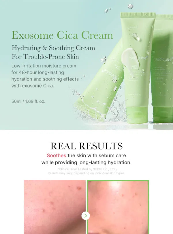Medicube Exosome Cica Cream 50 ml - Cremǎ de fațǎ calmantǎ, hidratantǎ, reparatoare cu exosomi de centella