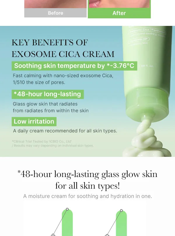 Medicube Exosome Cica Cream 50 ml - Cremǎ de fațǎ calmantǎ, hidratantǎ, reparatoare cu exosomi de centella