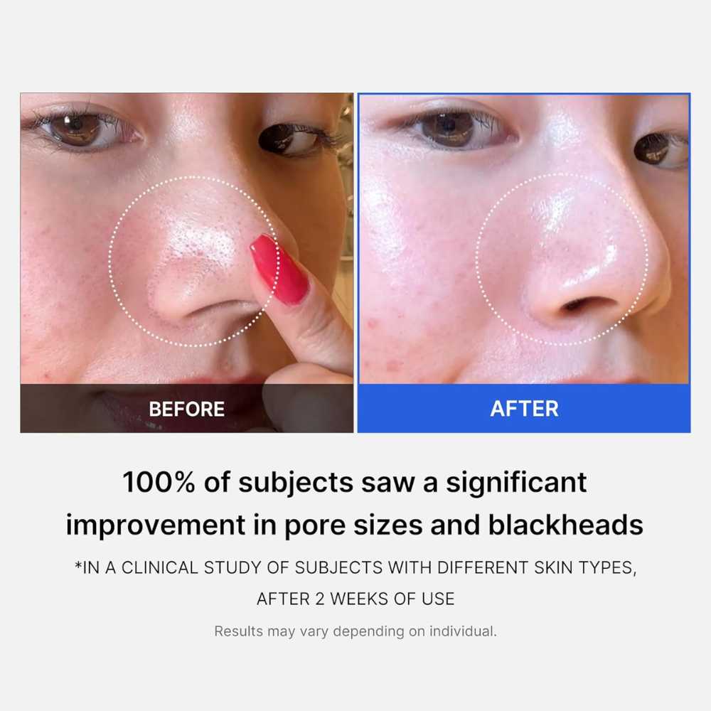 MEDICUBE Dischete exfoliante pentru fațǎ | ZERO PORE PAD 70 buc