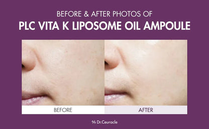 Dr. Ceuracle Ser cu Vitamina L 50ml