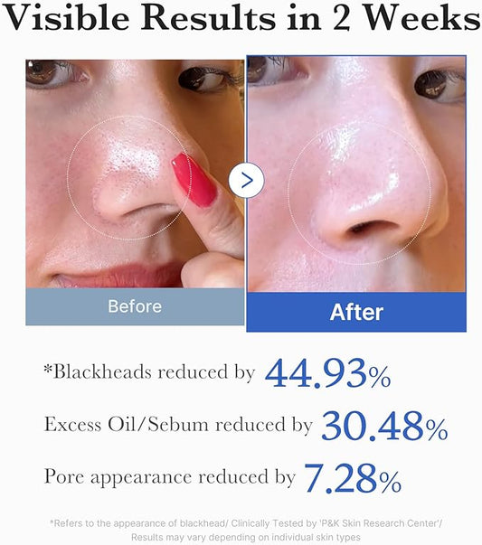 Medicube Zero Pore Pad 2.0 |  70 pads
