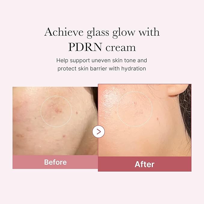 Medicube PDRN Pink Hyaluronic Moisturizing Cream 50ml