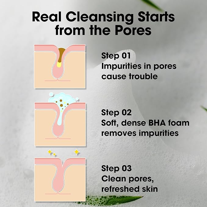 Somebymi AHA-BHA-PHA 30 Days Miracle Acne Clear Foam 100ml