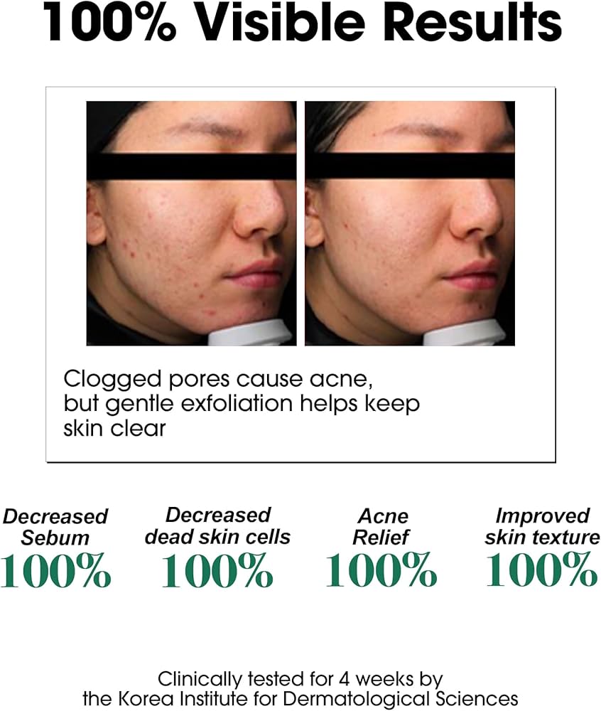 Somebymi AHA-BHA-PHA 30 Days Miracle Toner 150ml