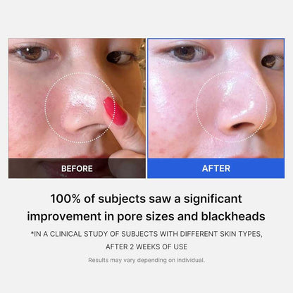 MEDICUBE Dischete exfoliante pentru fațǎ | ZERO PORE PAD 70 buc